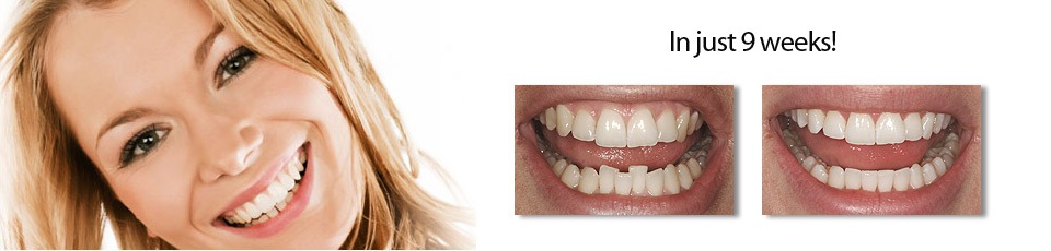 9 weeks before and after