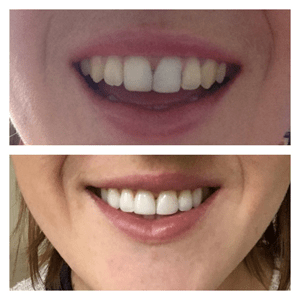 lucy testimonial