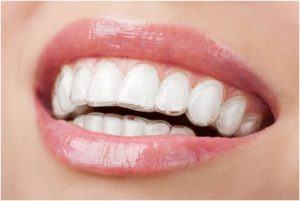 How To Make The Best Of Your Invisalign Treatment