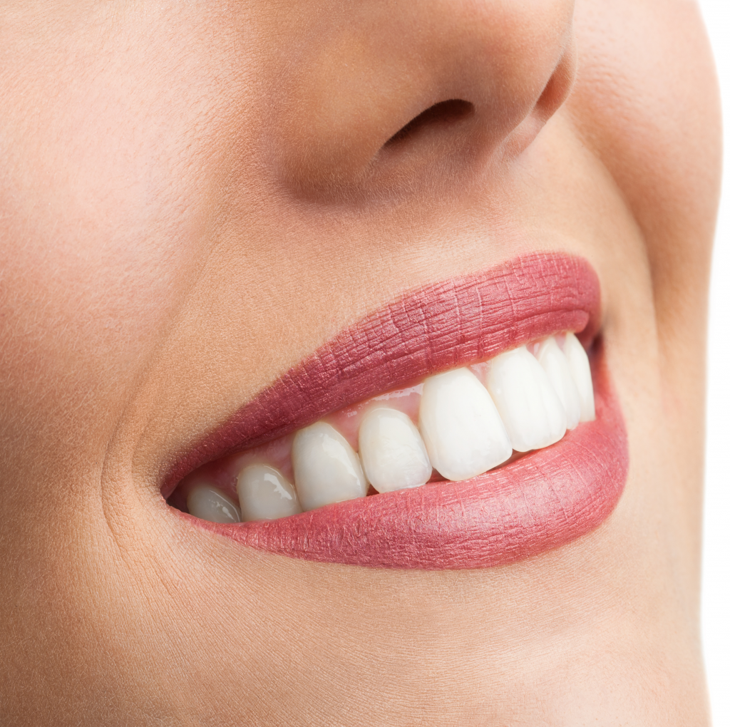 Teeth Whitening Cardiff Birchgrove Dental Practice