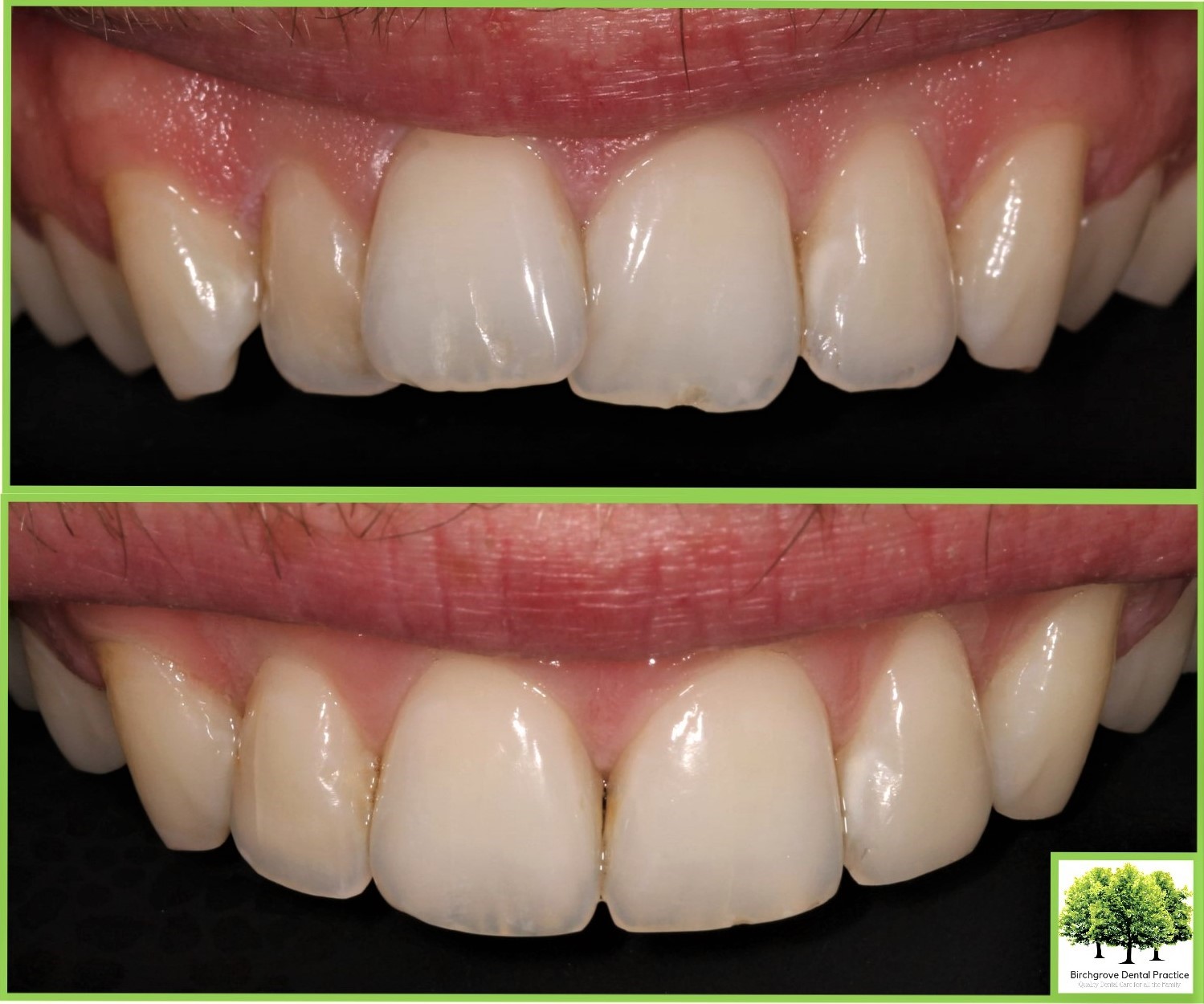 orthodontic