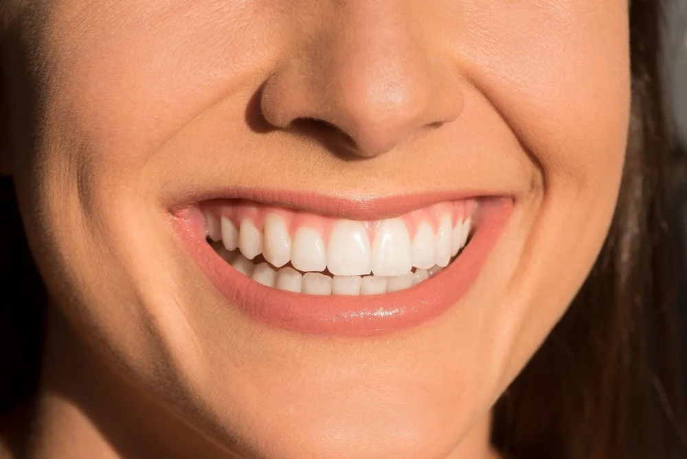 How long does composite bonding last.1 a woman smiling