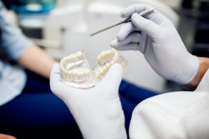How Do You Get Stains Out of Dentures?