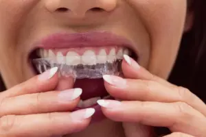 Can You Wear a Night Guard with Invisalign?