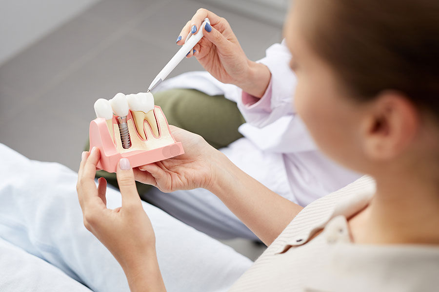 dental-implants in cardiff uk dental-implants in cardiff uk