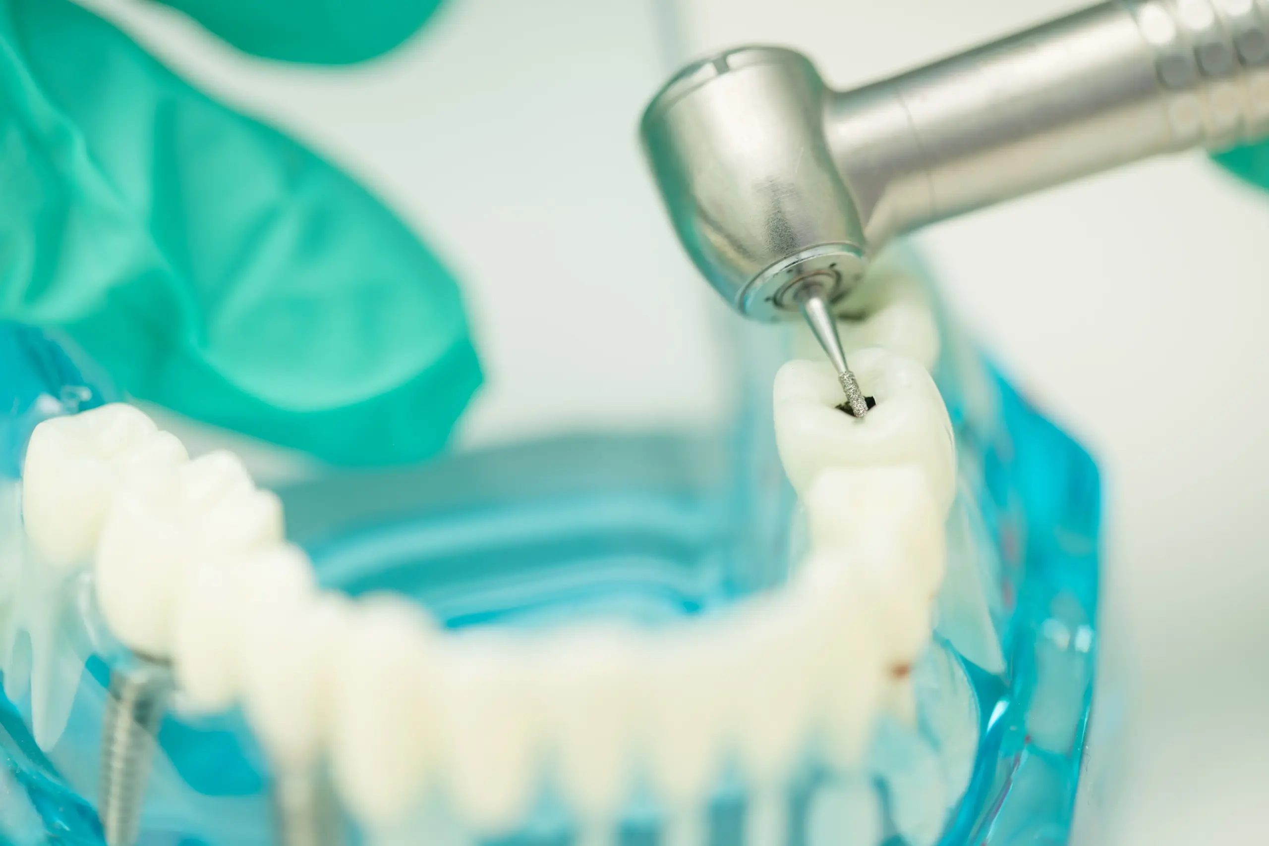 Close-up of a dental drill treating a tooth model, demonstrating how tooth fillings are done during cavity repair.