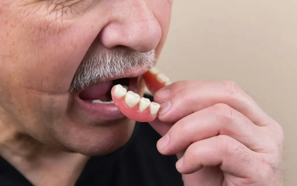 Older adult inserting a partial denture, illustrating a removable dental prosthesis for missing teeth.