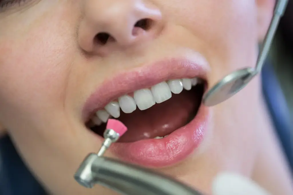 Polishing cup smoothing enamel after teeth shaving to reduce roughness and sensitivity.