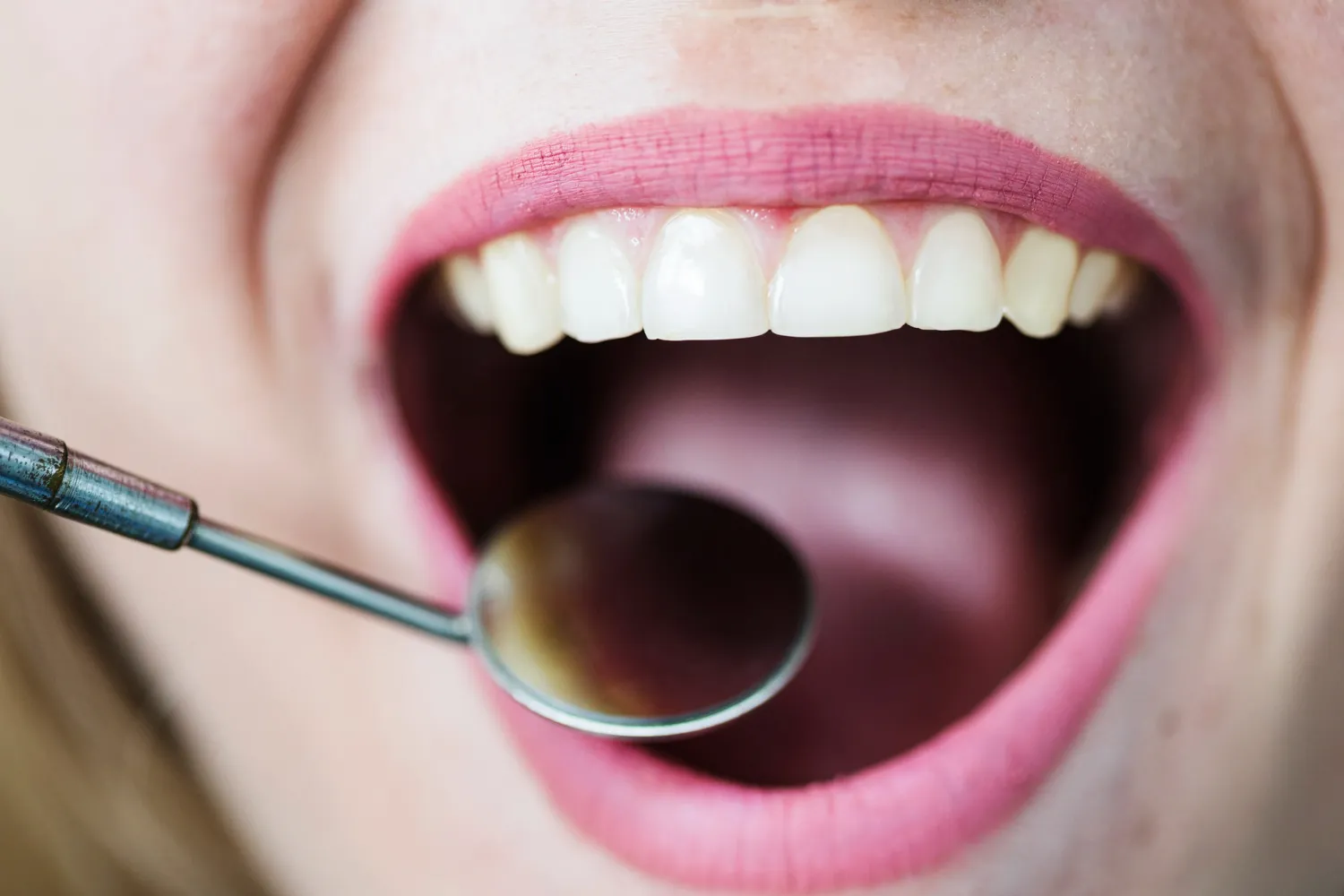 Close-up of a dental mirror being used to examine teeth.