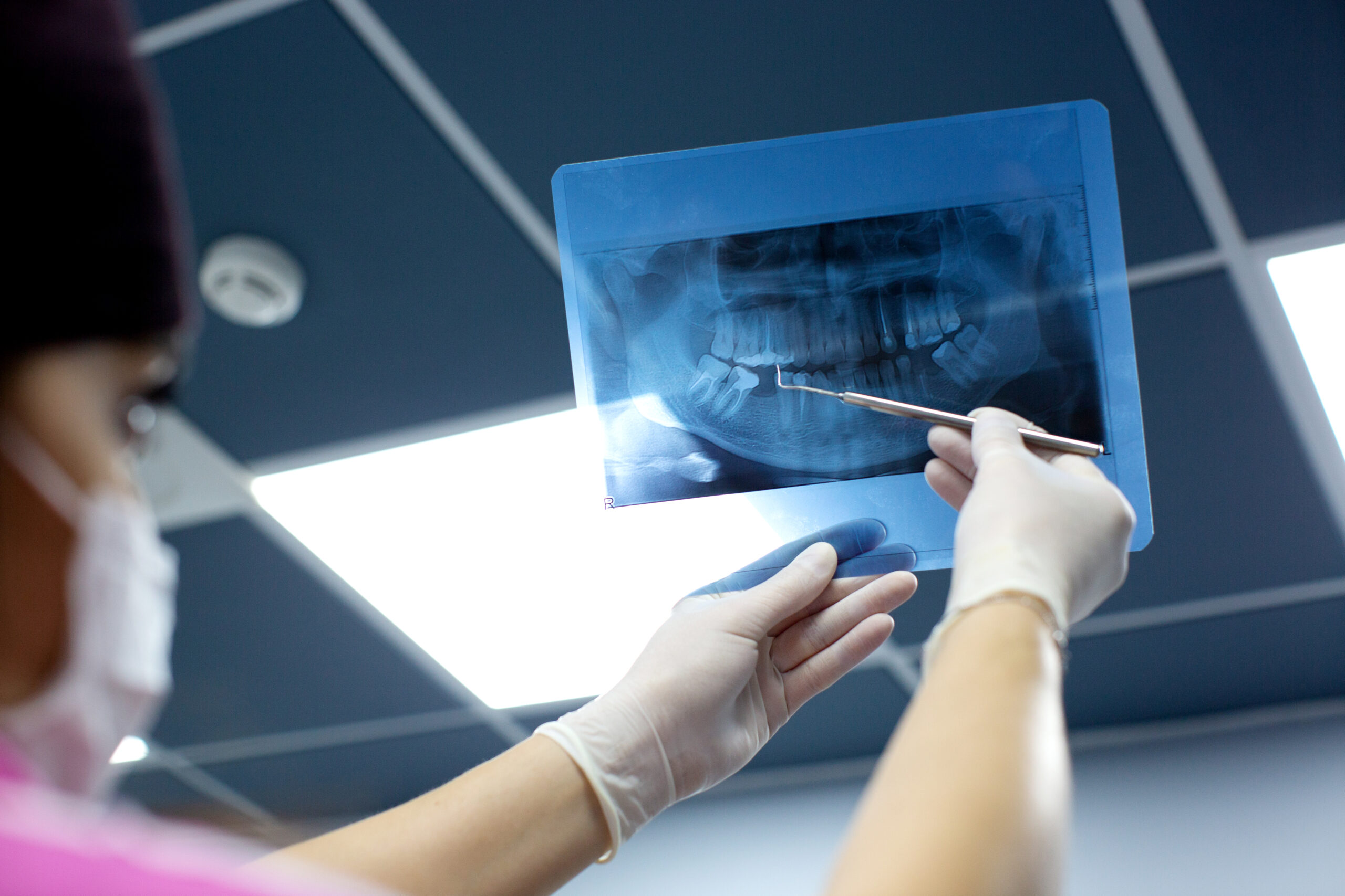 dental x rays