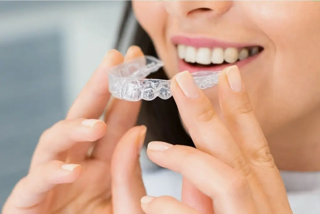 Clear aligners shown as an alternative to lingual braces.