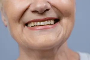 Composite Bonding for Gaps – Can It Close Spaces Between Teeth?
