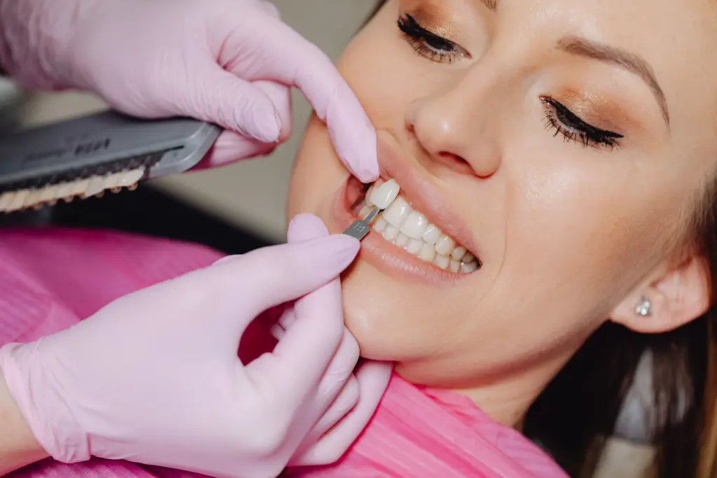 Dentist matching a veneer shade against a patient's natural teeth.