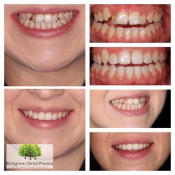 smile gallery 1