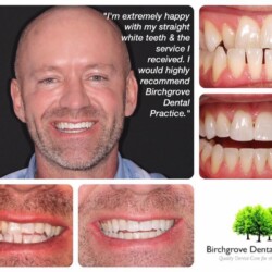 braces 10