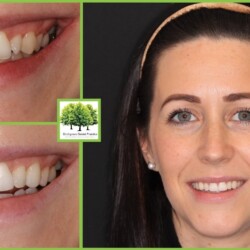 orthodontic patient