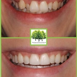 orthodontic care in cardiff