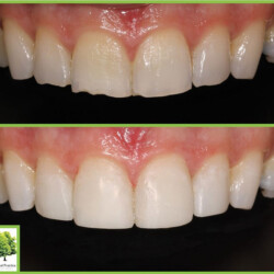 bonding case study south wales